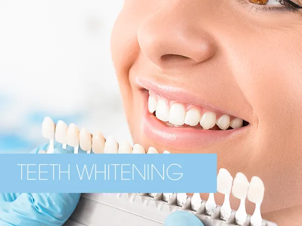 Teeth Whitening